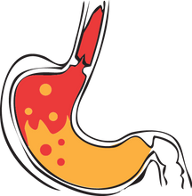 CARBON ACTIVADO (Activated Charcoal-90cap)