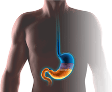 PRODUCTO NATURAL PARA LA GASTRITIS (GASTRI-LIFE)