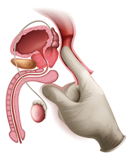 PRODUCTO NATURAL PARA LA PROSTATA