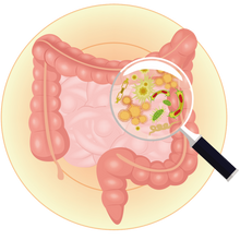 PROBLEMA INTESTINAL 100% NATURAL