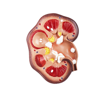 KIDNEY SUPPORT